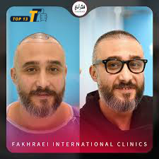 کلینیک کاشت مو فخرائی
